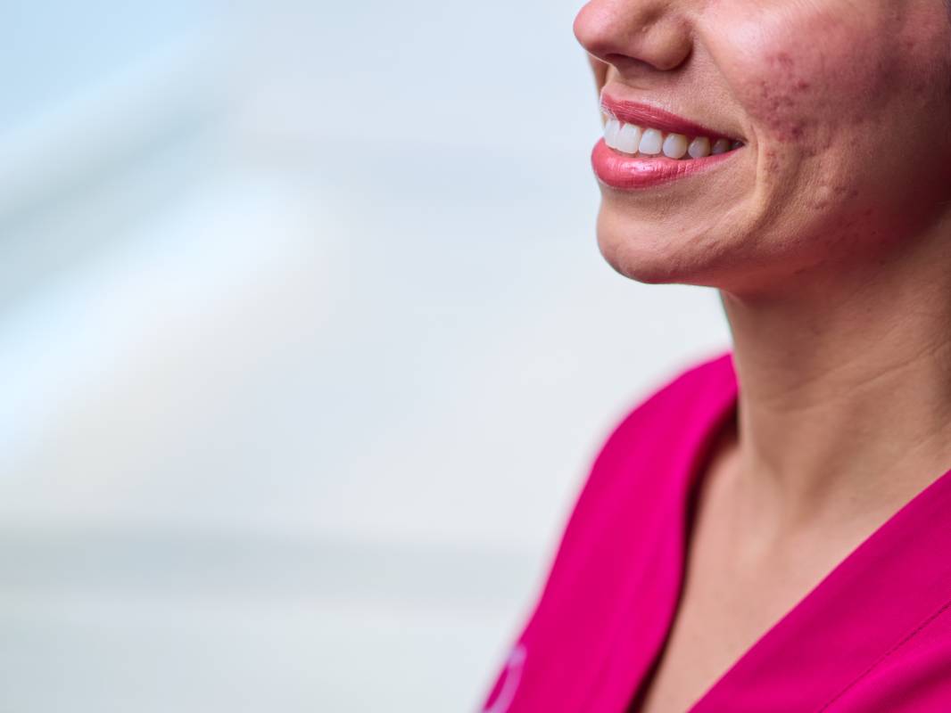 Primer plano lateral de una mujer sonriendo, mostrando dientes blancos y encías sanas.